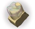 Nappy Lam DDS Cerec